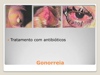 Dificuldade na relação com os pais e familiares.Rejeição dos pais.Dificuldade na relação consigo mesma e em ser aceite pelos outros.Receio de possíveis alterações no relacionamento com o seu namorado.Consequências gravidez precoce