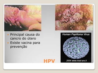 Abandono da escolaFalta de maturidade para educar umaCriançaDestruição de planos de vidaFalta de apoio financeiro para cuidar dacriançaConsequências gravidez precoce