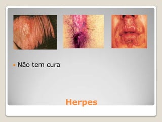 Ao iniciar a vida sexual activa é importante que regularmente faça:Teste de papanicolauMamografia e ecografia mamáriaEcografiasendovaginaisTeste de PSAVisitas regulares a ginecologistas e andrologistas (urologistas)Consultas de planeamento familiarEXAMES DE SAÚDE