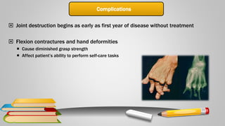 Complications
 Joint destruction begins as early as first year of disease without treatment
 Flexion contractures and hand deformities
 Cause diminished grasp strength
 Affect patient’s ability to perform self-care tasks
 