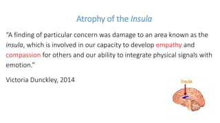 Atrophy of the Insula
“A finding of particular concern was damage to an area known as the
insula, which is involved in our capacity to develop empathy and
compassion for others and our ability to integrate physical signals with
emotion.”
Victoria Dunckley, 2014
 