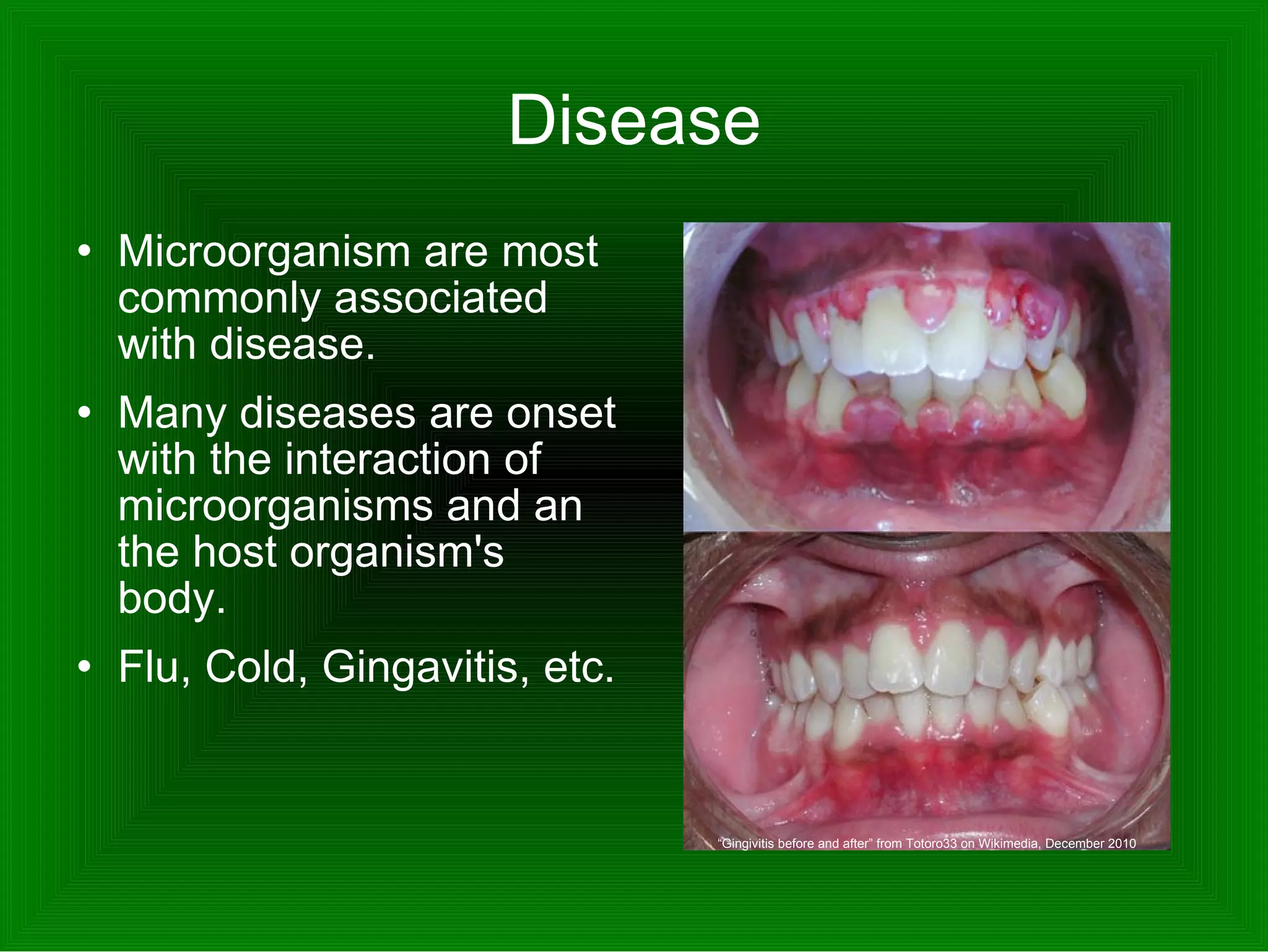 Disease Microorganism are most commonly associated with disease.  Many diseases are onset with the interaction of microorganisms and an the host organism's body.  Flu, Cold, Gingavitis, etc.  “ Gingivitis before and after” from Totoro33 on Wikimedia, December 2010 