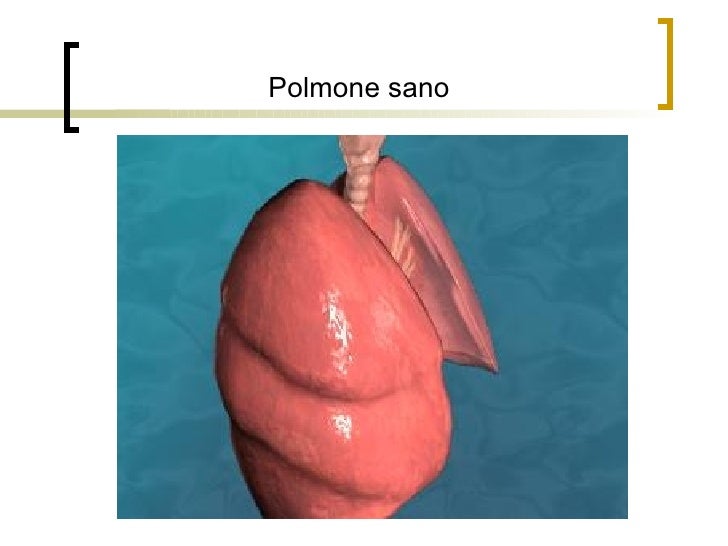 Il torace ha smesso di fumare e è fatto male