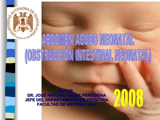 AUTOR:  DR. JOSÉ ANTONIO OSUNA PEREGRINA JEFE DEL DEPARTAMENTO DE PEDIATRIA FACULTAD DE MEDICINA UAG ABDOMEN AGUDO NEONATAL  (OBSTRUCCIÓN INTESTINAL NEONATAL) 2008 