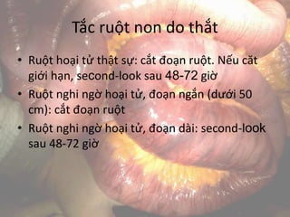 Tắc ruột non do thắt
• Ruột hoại tử thật sự: cắt đoạn ruột. Nếu căt
giới hạn, second-look sau 48-72 giờ
• Ruột nghi ngờ hoại tử, đoạn ngắn (dưới 50
cm): cắt đoạn ruột
• Ruột nghi ngờ hoại tử, đoạn dài: second-look
sau 48-72 giờ
 