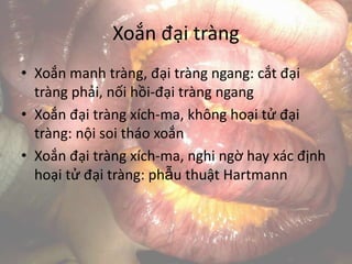 Xoắn đại tràng
• Xoắn manh tràng, đại tràng ngang: cắt đại
tràng phải, nối hồi-đại tràng ngang
• Xoắn đại tràng xích-ma, không hoại tử đại
tràng: nội soi tháo xoắn
• Xoắn đại tràng xích-ma, nghi ngờ hay xác định
hoại tử đại tràng: phẫu thuật Hartmann
 