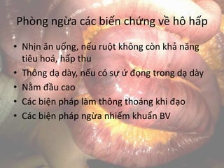 Phòng ngừa các biến chứng về hô hấp
• Nhịn ăn uống, nếu ruột không còn khả năng
tiêu hoá, hấp thu
• Thông dạ dày, nếu có sự ứ đọng trong dạ dày
• Nằm đầu cao
• Các biện pháp làm thông thoáng khi đạo
• Các biện pháp ngừa nhiếm khuẩn BV
 