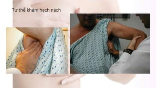 Tư thế khám hạch nách
 