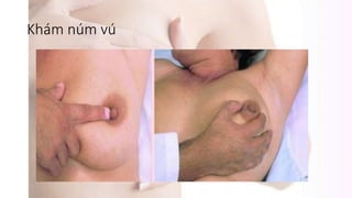 Khám núm vú
 