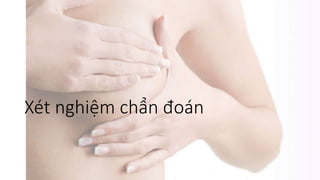 Xét nghiệm chẩn đoán
 