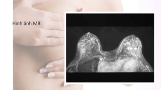 Hình ảnh MRI
 