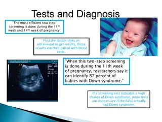  occurs when part of a chromosome 21becomes attached onto another chromosome, before or at conception.