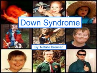Down Syndrome By: Natalie Brennan 