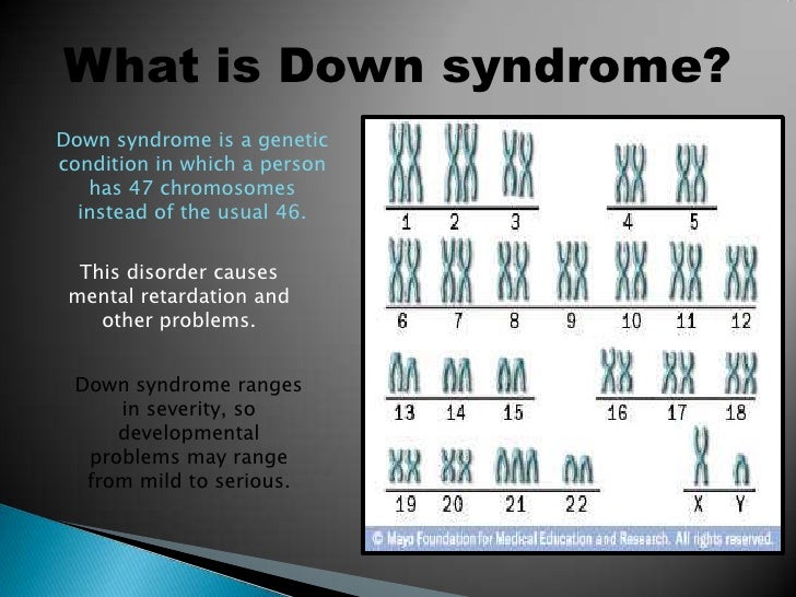 Down syndrome Down syndrome