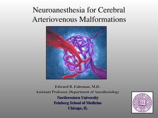 Neuroanesthesia for Cerebral
Arteriovenous Malformations
Edward B. Fohrman, M.D.
Assistant Professor, Department of Anesthesiology
Northwestern University
Feinberg School of Medicine
Chicago, IL
 
