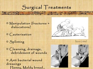 Surgical Treatments □  Manipulation (fractures +  dislocations) □  Cauterisation □  Splinting □  Cleansing, drainage,  debridement of wounds □  Anti bacterial wound dressings  Honey, Moldy bread… Nunn (1996) 