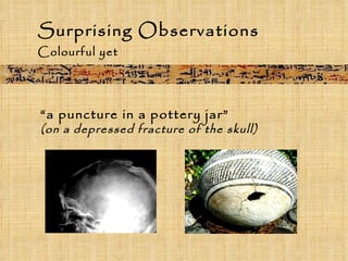 Surprising Observations   Colourful yet accurate “ a puncture in a pottery jar”  (on a depressed fracture of the skull) 