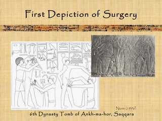 First Depiction of Surgery 6th Dynasty Tomb of Ankh-ma-hor, Saqqara Nunn (1996) 