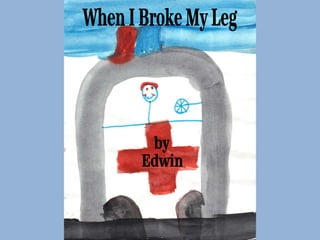 When I Broke My Leg by  Edwin 