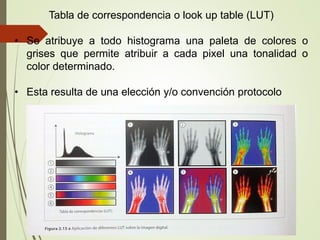 Tabla de correspondencia o look up table (LUT)
• Se atribuye a todo histograma una paleta de colores o
grises que permite atribuir a cada pixel una tonalidad o
color determinado.
• Esta resulta de una elección y/o convención protocolo
 