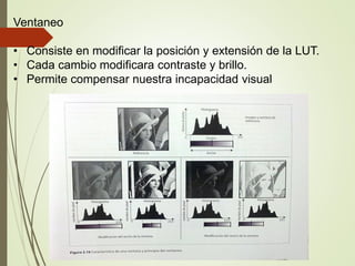Ventaneo
• Consiste en modificar la posición y extensión de la LUT.
• Cada cambio modificara contraste y brillo.
• Permite compensar nuestra incapacidad visual
 