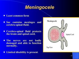 Meningocele Least common form  Sac contains meninges and cerebro-spinal fluid.  Cerebro-spinal fluid protects the brain and spinal cord.  The nerves are not badly damaged and able to function normally.  Limited disability is present .  