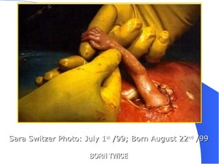 Sara Switzer Photo: July 1 st  /99; Born August 22 nd  /99  BORN TWICE 