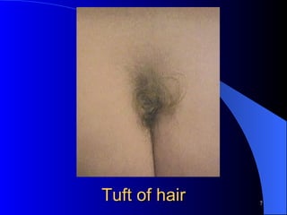 Tuft of hair 
