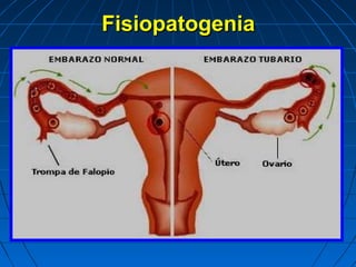 FisiopatogeniaFisiopatogenia
 