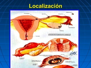 LocalizaciónLocalización
 