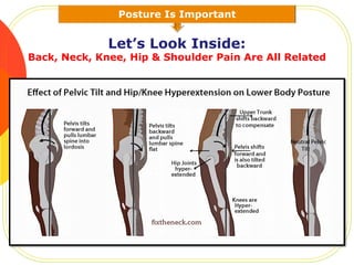 Posture Is Important
Let’s Look Inside:
Back, Neck, Knee, Hip & Shoulder Pain Are All Related
 