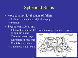 Sphenoid Sinus Most common local causes of failure Failure to enter at the original surgery Stenosis Special considerations Intracerebral injury:  CSF leak, meningitis, abscess, injury to pituitary gland Vascular hemorrhage Retrobulbar hematoma Cranial nerve injury Cavernous sinus fistula 