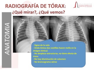 radiograf-a-de-t-rax-y-sus-interpretaci-n-pdf