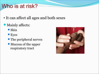 Who is at risk?
Mainly affects:
Skin
Eyes
The peripheral nerves
Mucosa of the upper
respiratory tract
• It can affect all ages and both sexes
 