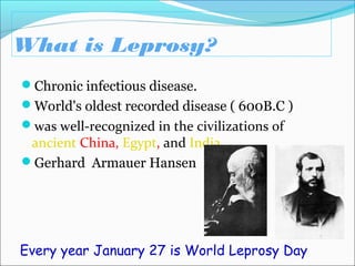 What is Leprosy?
Chronic infectious disease.
World's oldest recorded disease ( 600B.C )
was well-recognized in the civilizations of
ancient China, Egypt, and India.
Gerhard Armauer Hansen
Every year January 27 is World Leprosy Day
 