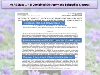 MSRE Stage 1 + 2: Combined Exstrophy and Epispadias Closures
faied repair (30), and delayed repair (5)
Results were comparable with conventional MSRE repair
However Osteotomy in this approach is necessary
 