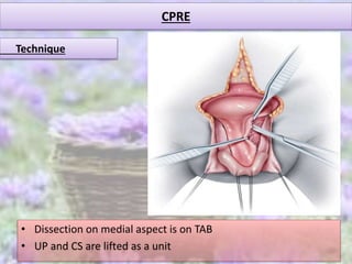 CPRE
• Dissection on medial aspect is on TAB
• UP and CS are lifted as a unit
Technique
 