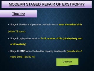 MODERN STAGED REPAIR OF EXSTROPHY
• Stage I: bladder and posterior urethral closure soon thereafter birth
(within 72 hours)
• Stage II: epispadias repair at 6–12 months of life (phalloplasty and
urethroplasty)
• Stage III: BNR when the bladder capacity is adequate (usually at 4–5
years of life) (BC 80 ml)
Timeline
Gearhart
 