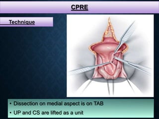 CPRE
• Dissection on medial aspect is on TAB
• UP and CS are lifted as a unit
Technique
 