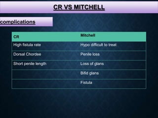 CR VS MITCHELL
complications
CR Mitchell
High fistula rate Hypo difficult to treat
Dorsal Chordee Penile loss
Short penile length Loss of glans
Bifid glans
Fistula
 