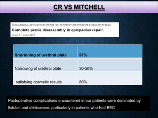 CR VS MITCHELL
Shortening of urethral plate 97%
Narrowing of urethral plate 30-50%
satisfying cosmetic results 80%
Postoperative complications encountered in our patients were dominated by
fistulas and dehiscence, particularly in patients who had EEC
 