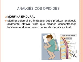 ANALGÉSICOS OPIOIDES
 MORFINA EPIDURAL
 Morfina epidural ou intratecal pode produzir analgesia
altamente efetiva, visto que alcança concentrações
localmente altas no corno dorsal da medula espinal.
 
