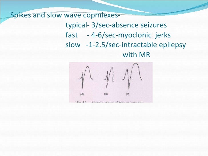 Eeg Basics Eeg Basics