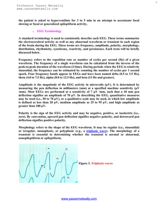 7
Professor Yasser Metwally
www.yassermetwally.com


 the patient is asked to hyperventilate for 3 to 5 min in an attempt to accentuate focal
 slowing or focal or generalized epileptiform activity.

           o   EEG Terminology

 A standard terminology is used to consistently describe each EEG. These terms summarize
 the electrocerebral activity as well as any abnormal waveform or transient in each region
 of the brain during the EEG. These terms are frequency, amplitude, polarity, morphology,
 distribution, rhythmicity, synchrony, reactivity, and persistence. Each term will be briefly
 discussed below.

 Frequency refers to the repetition rate or number of cycles per second (Hz) of a given
 waveform. The frequency of a single waveform can be calculated from the inverse of the
 peak-to-peak duration of the waveform (1/time). During periods when the EEG is relatively
 sinusoidal, the frequency can be estimated by counting the number of cycles per 1 second
 epoch. Four frequency bands appear in EEGs and have been named delta (0.5 to 3.5 Hz),
 theta (4.0 to 7.5 Hz), alpha (8.0 to 12.5 Hz), and beta (13 Hz and greater).

 Amplitude is the magnitude of the EEG activity in microvolts (µV). It is determined by
 measuring the pen deflection in millimeters (mm) at a specified machine sensitivity (µV
 /mm). Most EEGs are performed at a sensitivity of 7 µV /mm, such that a 10 mm pen
 deflection signifies an amplitude of 70 µV. In describing the EEG, quantitative measures
 may be used (i.e., 50 to 70 µV), or a qualitative scale may be used, in which low amplitude
 is defined as less than 20 µV, medium amplitude as 25 to 95 µV, and high amplitude as
 greater than 100 µV.

 Polarity is the sign of the EEG activity and may be negative, positive, or isoelectric (i.e.,
 zero). By convention, upward pen deflection signifies negative polarity, and downward pen
 deflection signifies positive polarity.

 Morphology refers to the shape of the EEG waveform. It may be regular (i.e., sinusoidal)
 or irregular, monophasic, or polyphasic (e.g., a triphasic wave). The morphology of a
 transient is essential to determining whether the transient is normal or abnormal,
 nonepileptiform or epileptiform.




                                               Figure 3. Triphasic waves




                                 www.yassermetwally.com
 