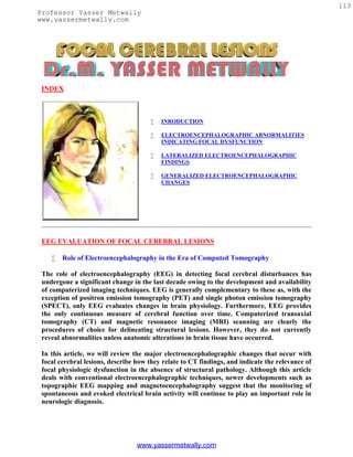 113
Professor Yasser Metwally
www.yassermetwally.com




 INDEX



                                          INRODUCTION

                                          ELECTROENCEPHALOGRAPHIC ABNORMALITIES
                                           INDICATING FOCAL DYSFUNCTION

                                          LATERALIZED ELECTROENCEPHALOGRAPHIC
                                           FINDINGS

                                          GENERALIZED ELECTROENCEPHALOGRAPHIC
                                           CHANGES




 EEG EVALUATION OF FOCAL CEREBRAL LESIONS

       Role of Electroencephalography in the Era of Computed Tomography

 The role of electroencephalography (EEG) in detecting focal cerebral disturbances has
 undergone a significant change in the last decade owing to the development and availability
 of computerized imaging techniques. EEG is generally complementary to these as, with the
 exception of positron emission tomography (PET) and single photon emission tomography
 (SPECT), only EEG evaluates changes in brain physiology. Furthermore, EEG provides
 the only continuous measure of cerebral function over time. Computerized transaxial
 tomography (CT) and magnetic resonance imaging (MRI) scanning are clearly the
 procedures of choice for delineating structural lesions. However, they do not currently
 reveal abnormalities unless anatomic alterations in brain tissue have occurred.

 In this article, we will review the major electroencephalographic changes that occur with
 focal cerebral lesions, describe how they relate to CT findings, and indicate the relevance of
 focal physiologic dysfunction in the absence of structural pathology. Although this article
 deals with conventional electroencephalographic techniques, newer developments such as
 topographic EEG mapping and magnetoencephalography suggest that the monitoring of
 spontaneous and evoked electrical brain activity will continue to play an important role in
 neurologic diagnosis.




                                  www.yassermetwally.com
 
