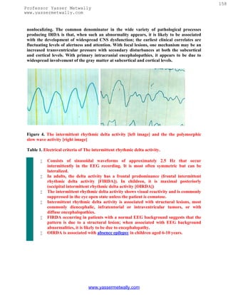 158
Professor Yasser Metwally
www.yassermetwally.com


 nonlocalizing. The common denominator in the wide variety of pathological processes
 producing IRDA is that, when such an abnormality appears, it is likely to be associated
 with the development of widespread CNS dysfunction; the earliest clinical correlates are
 fluctuating levels of alertness and attention. With focal lesions, one mechanism may be an
 increased transventricular pressure with secondary disturbances at both the subcortical
 and cortical levels. With primary intracranial encephalopathies, it appears to be due to
 widespread involvement of the gray matter at subcortical and cortical levels.




 Figure 4. The intermittent rhythmic delta activity [left image] and the the polymorphic
 slow wave activity [right image]

 Table 1. Electrical criteria of The intermittent rhythmic delta activity.

           Consists of sinusoidal waveforms of approximately 2.5 Hz that occur
            intermittently in the EEG recording. It is most often symmetric but can be
            lateralized.
           In adults, the delta activity has a frontal predominance (frontal intermittent
            rhythmic delta activity [FIRDA]). In children, it is maximal posteriorly
            (occipital intermittent rhythmic delta activity [OIRDA])
           The intermittent rhythmic delta activity shows visual reactivity and is commonly
            suppressed in the eye open state unless the patient is comatose.
           Intermittent rhythmic delta activity is associated with structural lesions, most
            commonly diencephalic, infratentorial or intraventricular tumors, or with
            diffuse encephalopathies.
           FIRDA occurring in patients with a normal EEG background suggests that the
            pattern is due to a structural lesion; when associated with EEG background
            abnormalities, it is likely to be due to encephalopathy.
           OIRDA is associated with absence epilepsy in children aged 6-10 years.




                                  www.yassermetwally.com
 