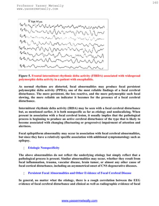 160
Professor Yasser Metwally
www.yassermetwally.com




 Figure 5. Frontal intermittent rhythmic delta activity (FIRDA) associated with widespread
 polymorphic delta activity in a patient with encephalitis.

 As normal rhythms are distorted, focal abnormalities may produce focal persistent
 polymorphic delta activity (PPDA), one of the most reliable findings of a focal cerebral
 disturbance. The more persistent, the less reactive, and the more polymorphic such focal
 slowing, the more reliable an indicator it becomes for the presence of a focal cerebral
 disturbance.

 Intermittent rhythmic delta activity (IRDA) may be seen with a focal cerebral disturbance
 but, as mentioned earlier, it is both nonspecific as far as etiology and nonlocalizing. When
 present in association with a focal cerebral lesion, it usually implies that the pathological
 process is beginning to produce an active cerebral disturbance of the type that is likely to
 become associated with changing (fluctuating or progressive) impairment of attention and
 alertness.

 Focal epileptiform abnormality may occur in association with focal cerebral abnormalities,
 but since they have a relatively specific association with additional symptomatology such as
 epilepsy.

       Etiologic Nonspecificity

 The above abnormalities do not reflect the underlying etiology but simply reflect that a
 pathological process is present. Similar abnormalities may occur, whether they result from
 focal inflammation, trauma, vascular disease, brain tumor, or almost any other cause of
 focal cortical disturbance, including an asymmetrical onset of CNS degenerative diseases.

       Persistent Focal Abnormalities and Other Evidence of Focal Cerebral Disease

 In general, no matter what the etiology, there is a rough correlation between the EEG
 evidence of focal cerebral disturbance and clinical as well as radiographic evidence of focal




                                   www.yassermetwally.com
 