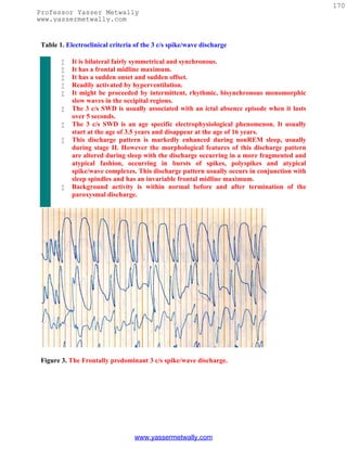 170
Professor Yasser Metwally
www.yassermetwally.com


 Table 1. Electroclinical criteria of the 3 c/s spike/wave discharge

           It is bilateral fairly symmetrical and synchronous.
           It has a frontal midline maximum.
           It has a sudden onset and sudden offset.
           Readily activated by hyperventilation.
           It might be proceeded by intermittent, rhythmic, bisynchronous monomorphic
            slow waves in the occipital regions.
           The 3 c/s SWD is usually associated with an ictal absence episode when it lasts
            over 5 seconds.
           The 3 c/s SWD is an age specific electrophysiological phenomenon. It usually
            start at the age of 3.5 years and disappear at the age of 16 years.
           This discharge pattern is markedly enhanced during nonREM sleep, usually
            during stage II. However the morphological features of this discharge pattern
            are altered during sleep with the discharge occurring in a more fragmented and
            atypical fashion, occurring in bursts of spikes, polyspikes and atypical
            spike/wave complexes. This discharge pattern usually occurs in conjunction with
            sleep spindles and has an invariable frontal midline maximum.
           Background activity is within normal before and after termination of the
            paroxysmal discharge.




 Figure 3. The Frontally predominant 3 c/s spike/wave discharge.




                                  www.yassermetwally.com
 