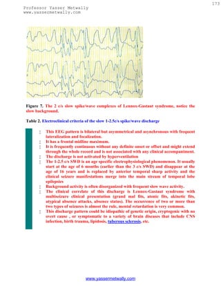 173
Professor Yasser Metwally
www.yassermetwally.com




 Figure 7. The 2 c/s slow spike/wave complexes of Lennox-Gastaut syndrome, notice the
 slow background.

 Table 2. Electroclinical criteria of the slow 1-2.5c/s spike/wave discharge

           This EEG pattern is bilateral but asymmetrical and asynchronous with frequent
            lateralization and focalization.
           It has a frontal midline maximum.
           It is frequently continuous without any definite onset or offset and might extend
            through the whole record and is not associated with any clinical accompaniment.
           The discharge is not activated by hyperventilation
           The 1-2.5 c/s SWD is an age specific electrophysiological phenomenon. It usually
            start at the age of 6 months (earlier than the 3 c/s SWD) and disappear at the
            age of 16 years and is replaced by anterior temporal sharp activity and the
            clinical seizure manifestations merge into the main stream of temporal lobe
            epilepsies
           Background activity is often disorganized with frequent slow wave activity.
           The clinical correlate of this discharge is Lennox-Gastaut syndrome with
            multiseizure clinical presentation (grand mal fits, atonic fits, akinetic fits,
            atypical absence attacks, absence status). The occurrence of two or more than
            two types of seizures is almost the rule, mental retardation is very common.
           This discharge pattern could be idiopathic of genetic origin, cryptogenic with no
            overt cause , or symptomatic to a variety of brain diseases that include CNS
            infection, birth trauma, lipidosis, tuberous sclerosis, etc.




                                  www.yassermetwally.com
 