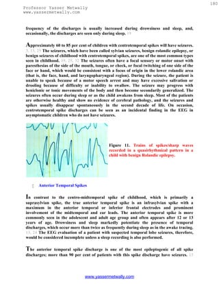 180
Professor Yasser Metwally
www.yassermetwally.com


 frequency of the discharges is usually increased during drowsiness and sleep, and,
 occasionally, the discharges are seen only during sleep. 19

 Approximately 60 to 85 per cent of children with centrotemporal spikes will have seizures.
 3, 13, 25 The seizures, which have been called sylvian seizures, benign rolandic epilepsy, or
 benign seizures of childhood with centrotemporal spikes, are one of the most common types
 seen in childhood. 19, 25, 32 The seizures often have a focal sensory or motor onset with
 paresthesias of the side of the mouth, tongue, or check, or focal twitching of one side of the
 face or hand, which would be consistent with a focus of origin in the lower rolandic area
 (that is, the face, hand, and laryngopharyngeal region). During the seizure, the patient is
 unable to speak because of a motor speech arrest and may have excessive salivation or
 drooling because of difficulty or inability to swallow. The seizure may progress with
 heniclonic or tonic movements of the body and then become secondarily generalized. The
 seizures often occur during sleep or as the child awakens from sleep. Most of the patients
 are otherwise healthy and show no evidence of cerebral pathology, and the seizures and
 spikes usually disappear spontaneously in the second decade of life. On occasion,
 centrotemporal spike discharges can be seen as an incidental finding in the EEG in
 asymptomatic children who do not have seizures.




                                               Figure 11. Trains of spikes/sharp waves
                                               recorded in a quasirhythmical pattern in a
                                               child with benign Rolandic epilepsy.




         Anterior Temporal Spikes

 In   contrast to the centro-midtemporal spike of childhood, which is primarily a
 suprasylvian spike, the true anterior temporal spike is an infrasylvian spike with a
 maximum in the anterior temporal or inferior frontal electrodes and prominent
 involvement of the midtemporal and ear leads. The anterior temporal spike is more
 commonly seen in the adolescent and adult age group and often appears after 12 or 13
 years of age. Drowsiness and sleep markedly potentiate the presence of temporal
 discharges, which occur more than twice as frequently during sleep as in the awake tracing.
 13, 24 The EEG evaluation of a patient with suspected temporal lobe seizures, therefore,
 would be considered incomplete unless a sleep recording is also performed.

 The   anterior temporal spike discharge is one of the most epileptogenic of all spike
 discharges; more than 90 per cent of patients with this spike discharge have seizures. 13




                                  www.yassermetwally.com
 